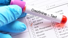 Chỉ số creatinin tăng có phải bị biến chứng thận do đái tháo đường?