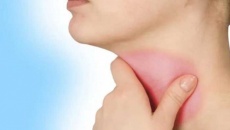Mẹo cải thiện viêm thanh quản tại nhà hiệu quả