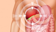 Một vài điều bạn cần biết khi có polyp túi mật