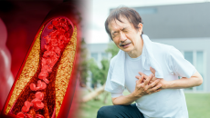 Mỡ máu cao - “Thủ phạm thầm lặng” gây đột quỵ, nhồi máu cơ tim