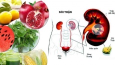 Chuyên gia chỉ cách ăn uống cực kỳ đơn giản 'đánh tan' sỏi thận