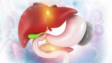 Bạn cần biết gì về polyp túi mật?