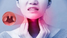 Viêm họng bao lâu thì khỏi?