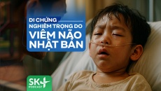 Podcast: Di chứng nghiêm trọng do viêm não Nhật Bản