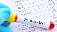 Chỉ số acid uric cao ảnh hưởng thế nào tới sức khỏe?