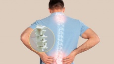 Ứng dụng công nghệ sinh học trong điều trị loãng xương mức độ nặng