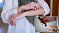 Tại sao người bệnh đái tháo đường thường hay bị nhiễm trùng da?