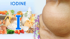 Đừng chủ quan với bướu cổ do thiếu iod