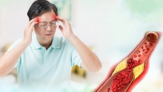 Mỡ máu cao là do đâu?
