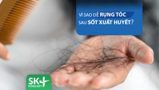 Podcast: Vì sao dễ bị rụng tóc sau sốt xuất huyết?