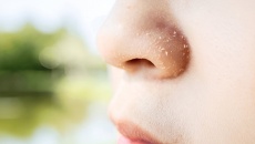 Mẹo hay giải cứu cho vùng da khô quanh mũi