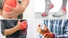 Bạn có biết ai dễ bị đau xương khớp?
