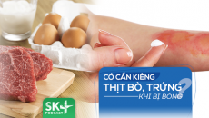 Podcast: Có cần kiêng thịt bò, trứng khi bị bỏng?