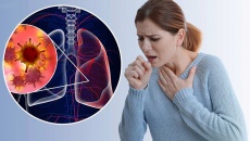 Ung thư phổi giai đoạn sớm có chữa được không?