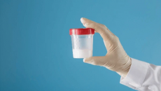 Hệ vi sinh vật ảnh hưởng thế nào tới chất lượng tinh trùng?