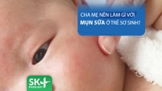 Podcast: Cha mẹ nên làm gì với mụn sữa ở trẻ sơ sinh?