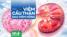 Podcast: Cảnh giác viêm cầu thận sau viêm họng