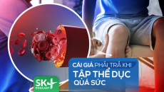 Podcast: Cái giá phải trả khi tập thể dục quá sức