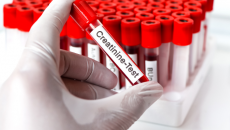 Làm thế nào để ổn định nồng độ creatinine ở bệnh nhân suy thận?