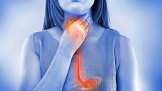 Trào ngược dạ dày thực quản làm tăng nguy cơ đau tim?