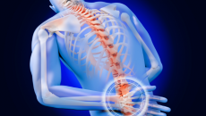 Bật mí cách giảm đau lưng hiệu quả tại nhà 