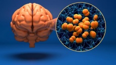 Hà Nội phát hiện ca mắc bệnh não mô cầu thứ 3 trong năm 