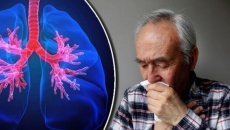 Người bị viêm phổi mạn tính nên điều trị như thế nào?