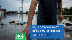 Podcast: Nguy cơ bùng phát bệnh Whitmore sau mưa lũ