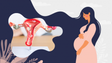 Bị nhân xơ tử cung có thai được không?