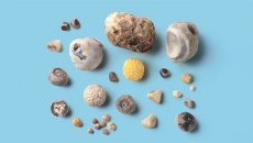 Sỏi mật 7mm: Dùng TPBVSK Kim Đởm Khang được không?