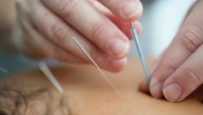 Châm cứu giúp bệnh nhân ung thư vú vượt qua chứng 'sương mù não'