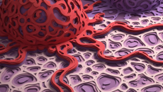 Biểu hiện của khối u ác tính như thế nào?