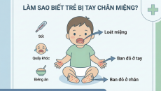 Làm sao để biết trẻ bị tay chân miệng?