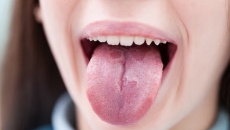 Thủ phạm “quen mặt” tăng nguy cơ ung thư miệng lên 50%