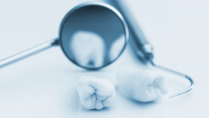 4 thói quen không nên làm trước buổi khám nha khoa