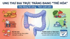 Khi nào người trẻ cần đi tầm soát ung thư đại trực tràng?