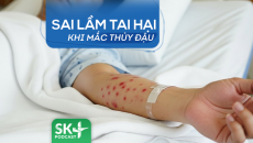 Podcast: Sai lầm tai hại khi mắc thủy đậu  
