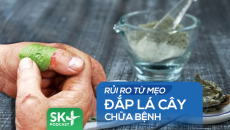 Podcast: Rủi ro từ mẹo đắp lá cây chữa bệnh