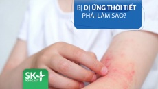 Podcast: Bị dị ứng thời tiết phải làm sao? 