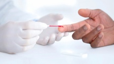 Hướng dẫn mới: Theo dõi chỉ số cholesterol từ khi còn trẻ