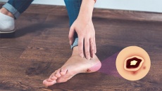 Bạn cần biết gì về biến chứng bàn chân do đái tháo đường?