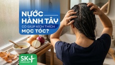 Podcast: Nước hành tây có giúp kích thích mọc tóc?