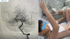 Bé trai 10 tuổi suýt liệt nửa người sau khi đi chơi cầu lông