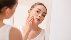 Infographic: Tại sao người trưởng thành vẫn có thể bị mụn?