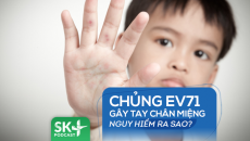 Podcast: Chủng tay chân miệng EV71 nguy hiểm ra sao?