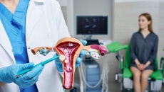 Các yếu tố ảnh hưởng đến u xơ tử cung sau tuổi 30