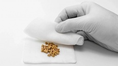 Vì sao sỏi mật 11mm kèm mỡ máu cao lại gây đầy hơi, khó tiêu?