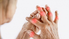 6 bí quyết kiểm soát acid uric, ngăn chặn cơn đau gout cấp