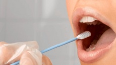Xét nghiệm nước bọt tại nhà giúp phát hiện sớm ung thư dạ dày