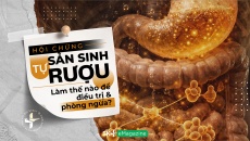 Hội chứng tự sản sinh rượu: Làm thế nào để điều trị và phòng ngừa?